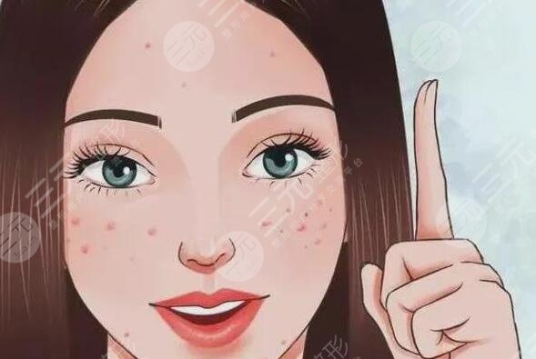 缓解青春痘费用大概多少钱？哪些方法有效且安全可靠？