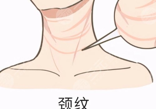 颈纹怎么消除?