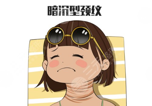 颈纹怎么消除?