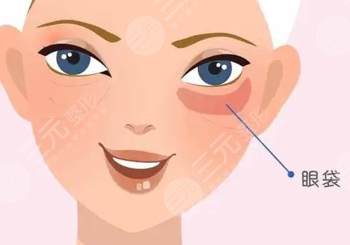 眼袋怎么消除？
