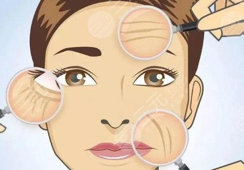 7d聚拉提美容的功效和副作用有哪些?