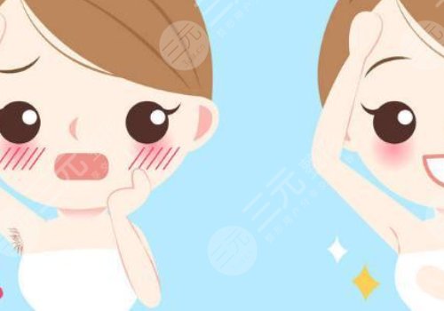 激光脱毛和冰点脱毛有什么区别？