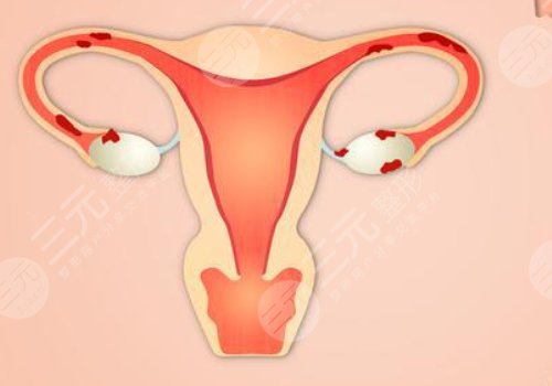 女性私处修复手术大概多少钱?