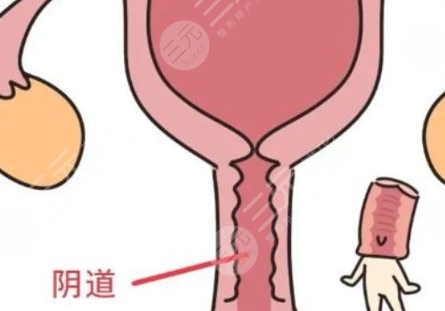 女性私处修复手术大概多少钱?