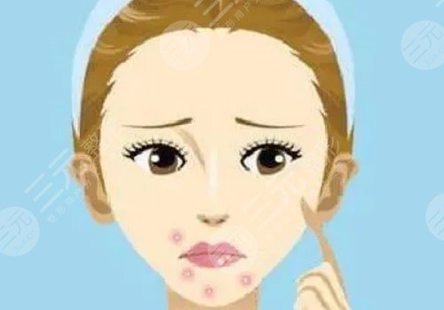 口周一直长痘痘什么原因？