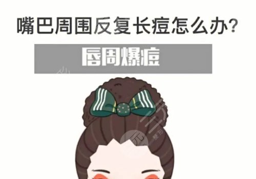 口周一直长痘痘什么原因？