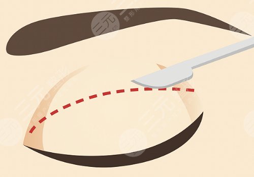 哈尔滨双燕医美怎么样?