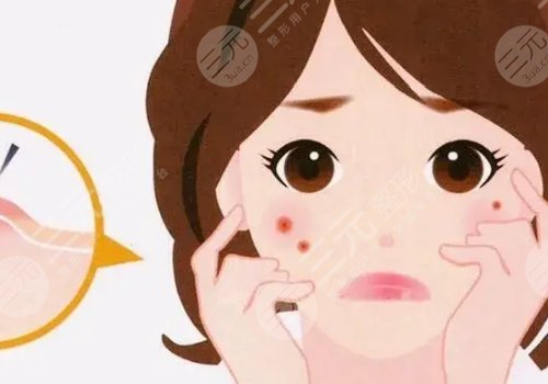 脸上痘坑怎么去除？