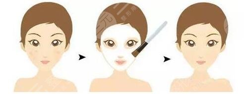 果酸换肤需要慎重选择美容院和医生