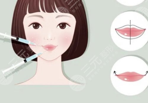 瑞蓝玻尿酸正品价格是多少?