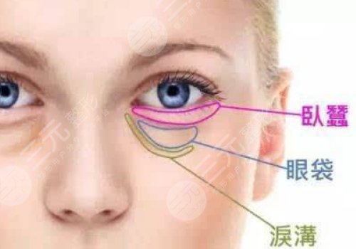 泪沟与眼袋的区别图