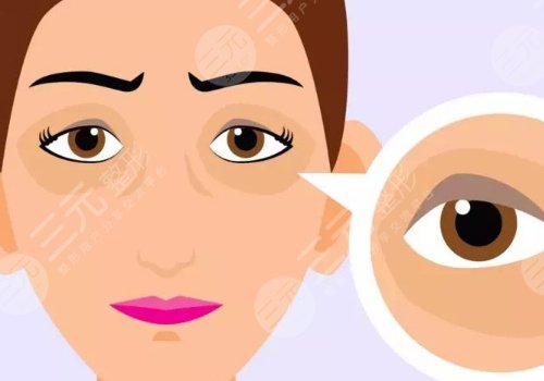 泪沟与眼袋的区别图