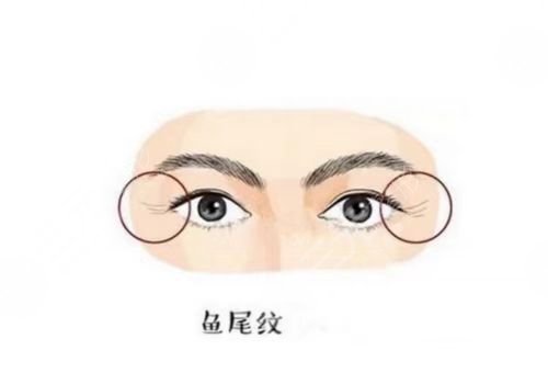高士乾双眼皮修复价格2023