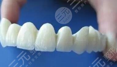 全瓷牙