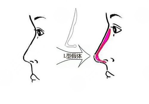 广州军美医疗美容门诊部怎么样?