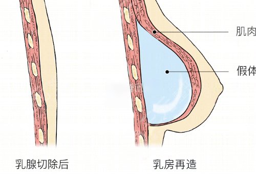 高士乾双眼皮做得好吗?