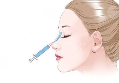 爱贝芙隆鼻会变宽吗