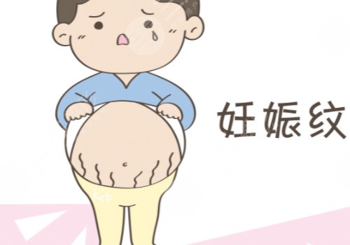 如何消除妊娠纹?
