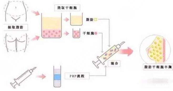 蒋小花医生擅长项目科普