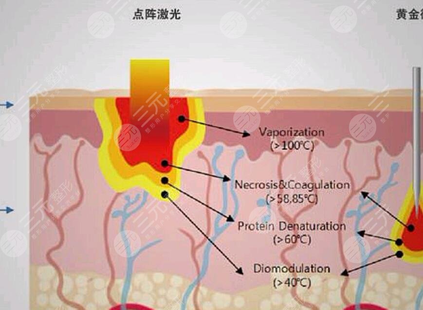 点阵像素激光是什么原理?