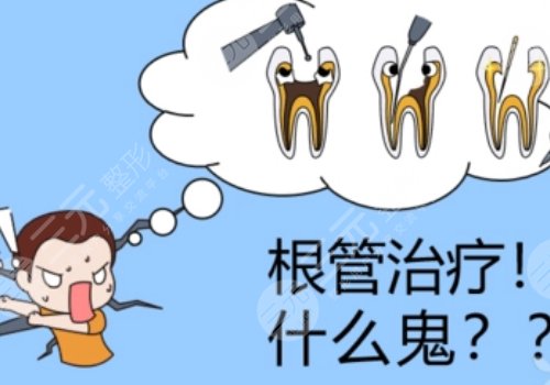 根管缓解一颗全部费用