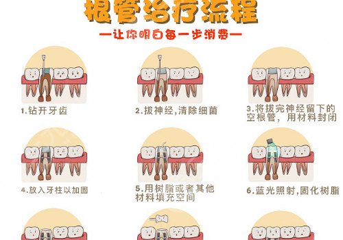 根管缓解一颗全部费用