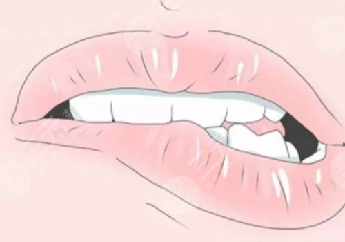 嘴唇厚如何变薄?