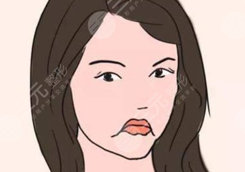 厚唇改薄能维持多久