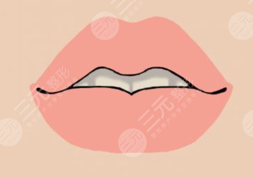 厚唇改薄能维持多久