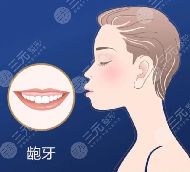 暴牙矫正的方式以及相应价格