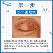 切开双眼皮过程图解！术前必看扫盲小课堂！