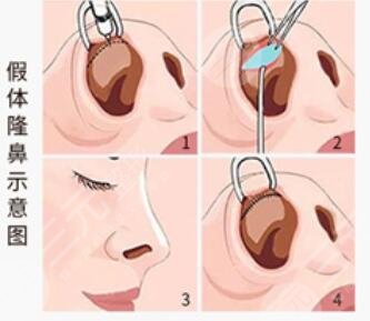 卢建医生信息介绍