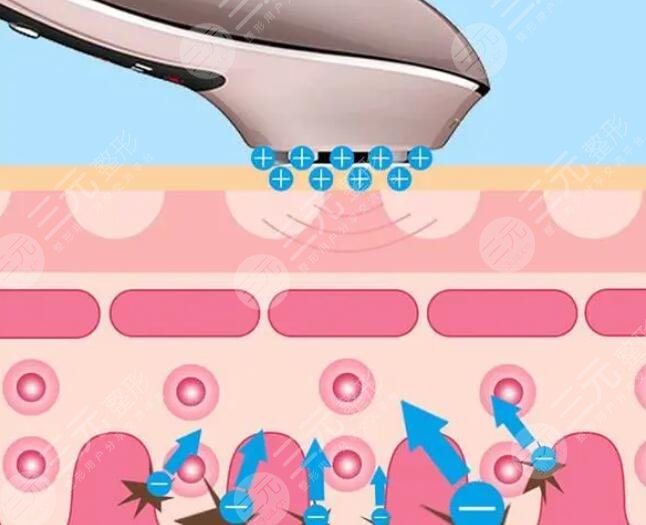 美容仪分类及效果