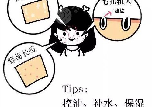 油性皮肤护理方案揭晓