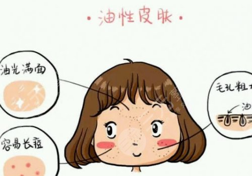 油性皮肤护理方案揭晓