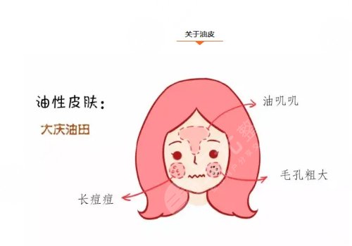 油性皮肤护理方案揭晓
