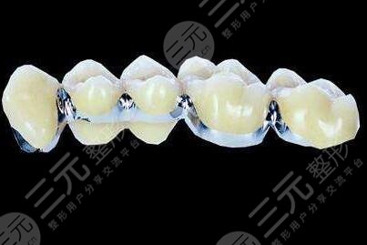 全瓷牙一颗1000元贵吗？平均价位是多少？价格波动的因素