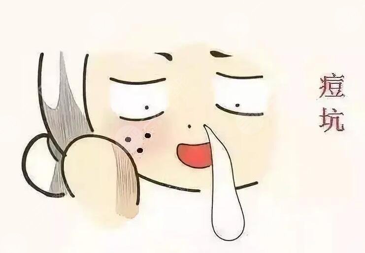 激光磨皮去痘印有效吗？手术注意事项有哪些？哪些人适合做？