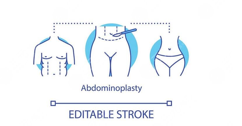 腹壁整形术多少钱?