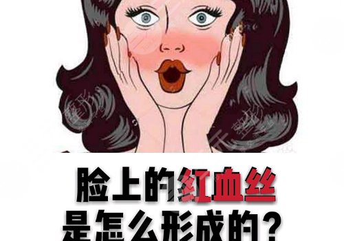 怎么减少红血丝的产生？