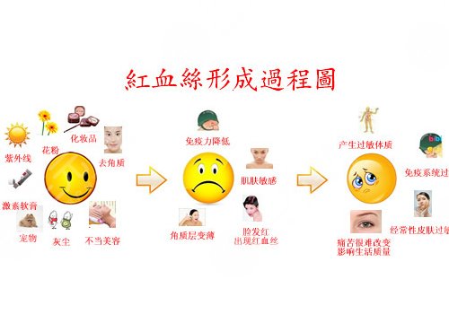 怎么减少红血丝的产生？