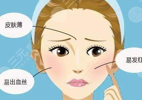 怎么减少红血丝的产生?