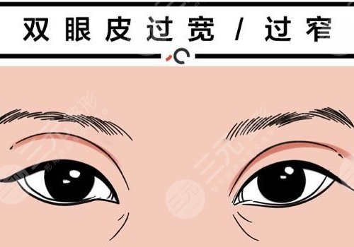 双眼皮修复大概多少钱呢？