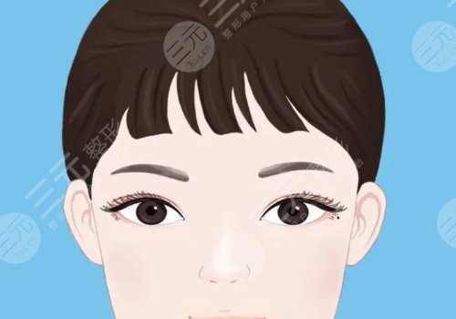 双眼皮修复大概多少钱呢？