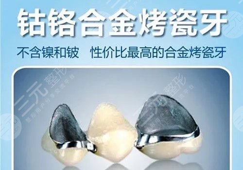 烤瓷牙多少钱一颗价格表2023