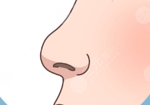 硅胶隆鼻假体可以维持一辈子吗？