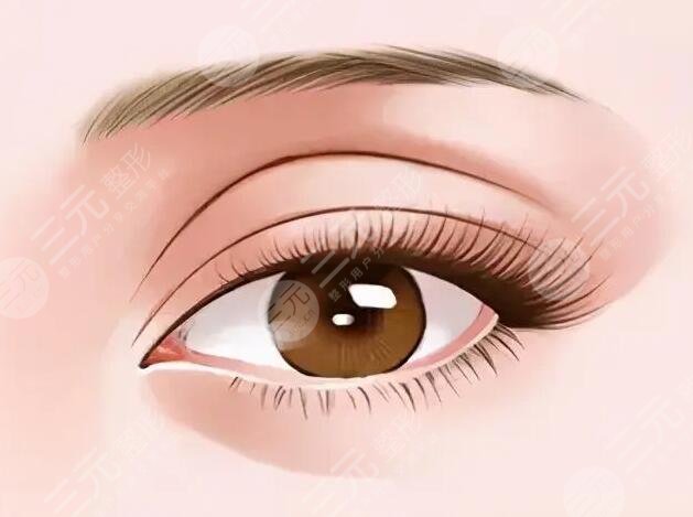 眼睑皮肤松弛矫正术适合哪些人群?