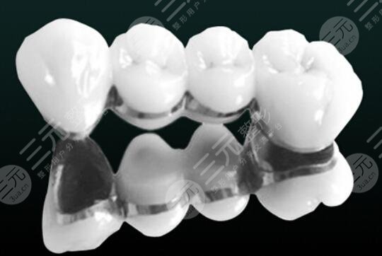 全瓷牙一颗大概多少钱呢?