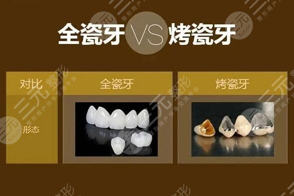 全瓷牙一颗大概多少钱呢？文中4个因素在影响手术价格！