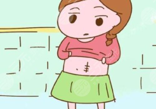 有伤疤怎么去掉？